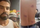 PMs são afastados após denúncia de agressões e homofobia no Carnaval.